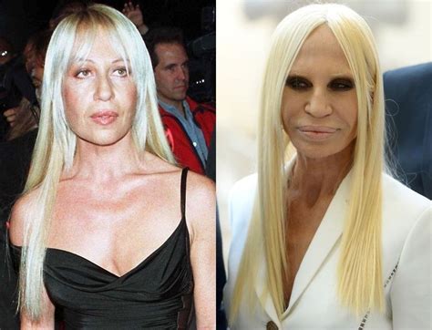 donatella versace before and after|Donatella Versace personal life.